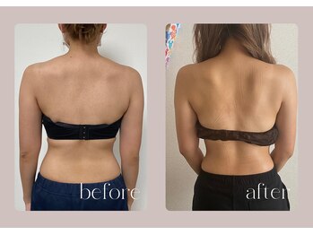 ステラ(STELLA)/頭皮ほぐし付き!