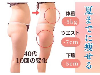 エルナ(Eluna)の写真/何をしても変わらない体重にサヨナラ！更年期太りも諦めない、理想の私へ導くサイズダウンエステ♪