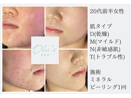 オルズ(Olu's)の写真