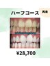 【効果しっかり実感したい方◎】美白セルフホワイトニング40分×5回 ¥28,700