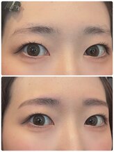 エンドアイ(&i)/【アイブロウ】ビフォーアフター