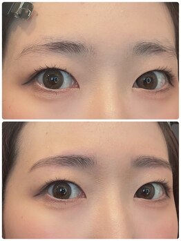 エンドアイ(&i)/【アイブロウ】ビフォーアフター