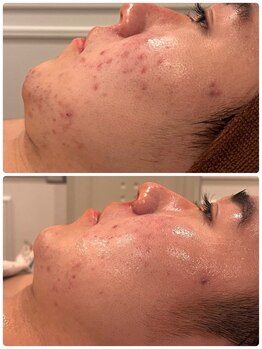 レヴール 京都四条烏丸店(Reveur)/お客様BA（陶肌）2