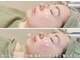リムビューティー 自由が丘(RymBeauty)の写真