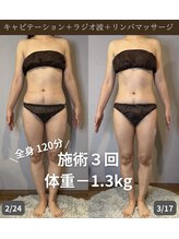 エネイブル(ENable)/