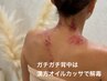 温漢方デトックスカッサダイエット 【背中+ 美脚カッサ】浮腫み肩凝り冷え