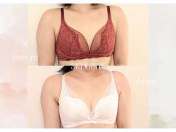 ルナ 千葉(LUNA)/3回施術後