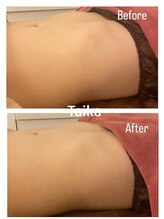 タイカ(Taika)/肋骨ケアでバストアップ近道に！