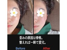 美容矯正サロン レレポノ(LELEPONO)/