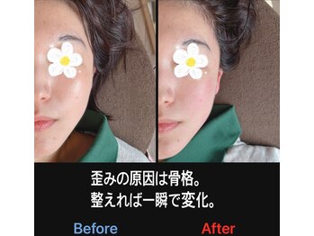 美容矯正サロン レレポノ(LELEPONO)/