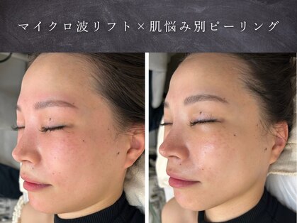 イロハ(IROHA)の写真