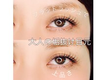 レッドハウス(RED HOUSE)の雰囲気(拘りの前処理と施術でモチアップ◎)