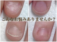 アメジスト(Amethyst)