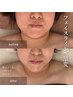 【肌育ボンバーフェイシャル】結果が違う！リフト級小顔◎毛穴レス艶肌/100分