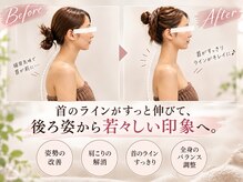デトックススパボディーラボの雰囲気（【ガチガチ首肩こりに】最新筋膜マシンで巻き肩・姿勢を根本改善）