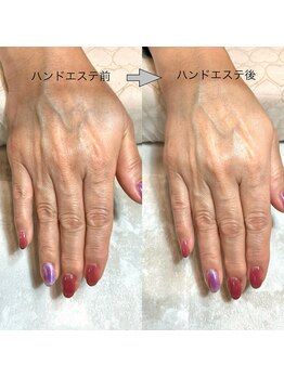 リンク(LINK)/ハンドエステ