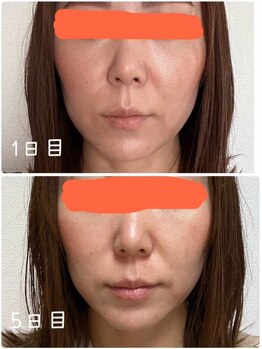 エル(eL)/体調が劇的に改善!