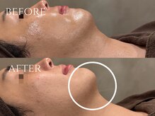 ウード(oud.)/小顔人気No.1メニュー☆