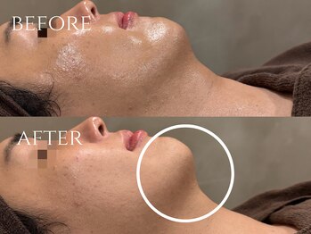 ウード(oud.)/小顔人気No.1メニュー☆