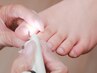 【軽度巻き爪・肥厚爪】爪のお悩みの方→爪シンプルコース（所要時間約70分）