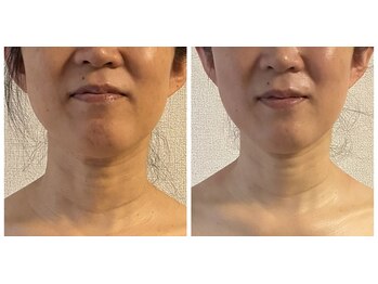 よす香/ビフォーアフター