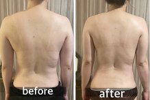 リムアール(Limh R)