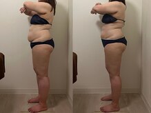 アル 本町店(allu)/お腹周りが変わる｜1ヶ月