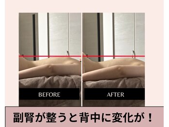 ルナリア(Lunaria)/1回の施術で変化を実感できます