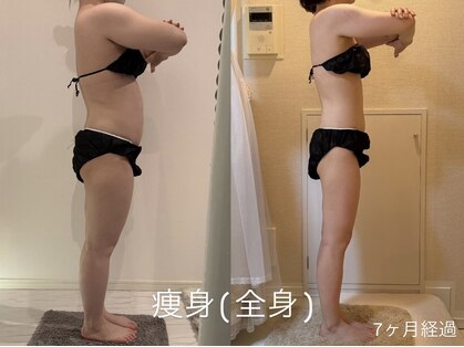 CLERA 恵比寿｜鍼灸院【小顔/リフトアップ/たるみ/エラ張り/毛穴】の写真