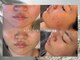 キュレイテッドスキン(CURATED SKIN)の写真