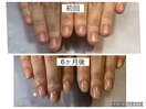 自爪育成で別人級！