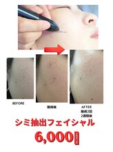 ファム 蓮台寺店(FAM)&nbsp;シミ抽出 