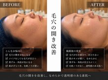 美整庵 谷山店(BISEIAN)の雰囲気(毛穴、くすみ改善|ダウンタイムのない肌質改善)