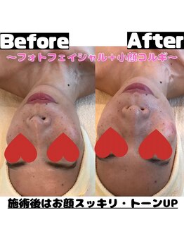 エステジュン(ESTHE JUN)/