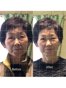 えがお整体院/1回の施術で効果のある小顔美容