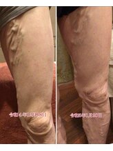 エル(eL)/えっっ！