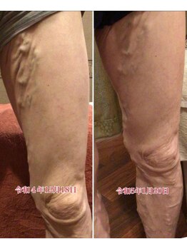 エル(eL)/えっっ!