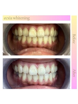 エクシアホワイトニング 王寺店/