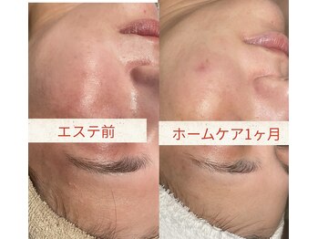 インチャント(enchant)/スキンケアは、選び方、使い方