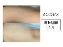 メンズビオ 神戸三宮店/