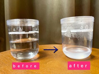 エスポリー(ESPORY)/毛穴すっきりの最新マシン♪