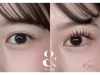 タグシー 紀の川打田店(#She)/&ヘルシー　ビフォーアフター