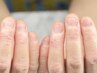 《hand》深爪・爪噛み 改善《自爪育成3回コース》(1回辺り/¥6,000×3回分)