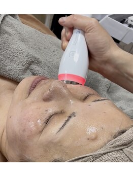 ボータン 恵(Beau Temps)の写真/シミ改善だけでは終わらない。「くすみ・色むら・赤み・ハリまで」肌質から育てるウルトラ光トーニング