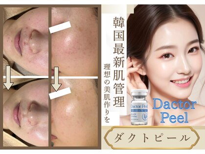 ルーセントの写真