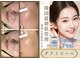 ルーセントの写真
