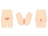 【全員】男性VIO脱毛セット￥7500★Vライン単体等1部位￥2500