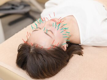 ピアーズ鍼灸整骨院の写真/加齢・お肌のコンディションが下がった、ニキビ・肌荒れにお悩みの方に!当店の美容鍼にお任せください★