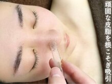 エステの森ジュジュ/毛穴ケアバキューム