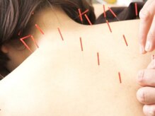 バランス鍼灸整骨院/自律神経　更年期　パニック　